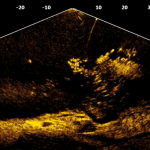 Transductor ActiveTarget - Imagen 9